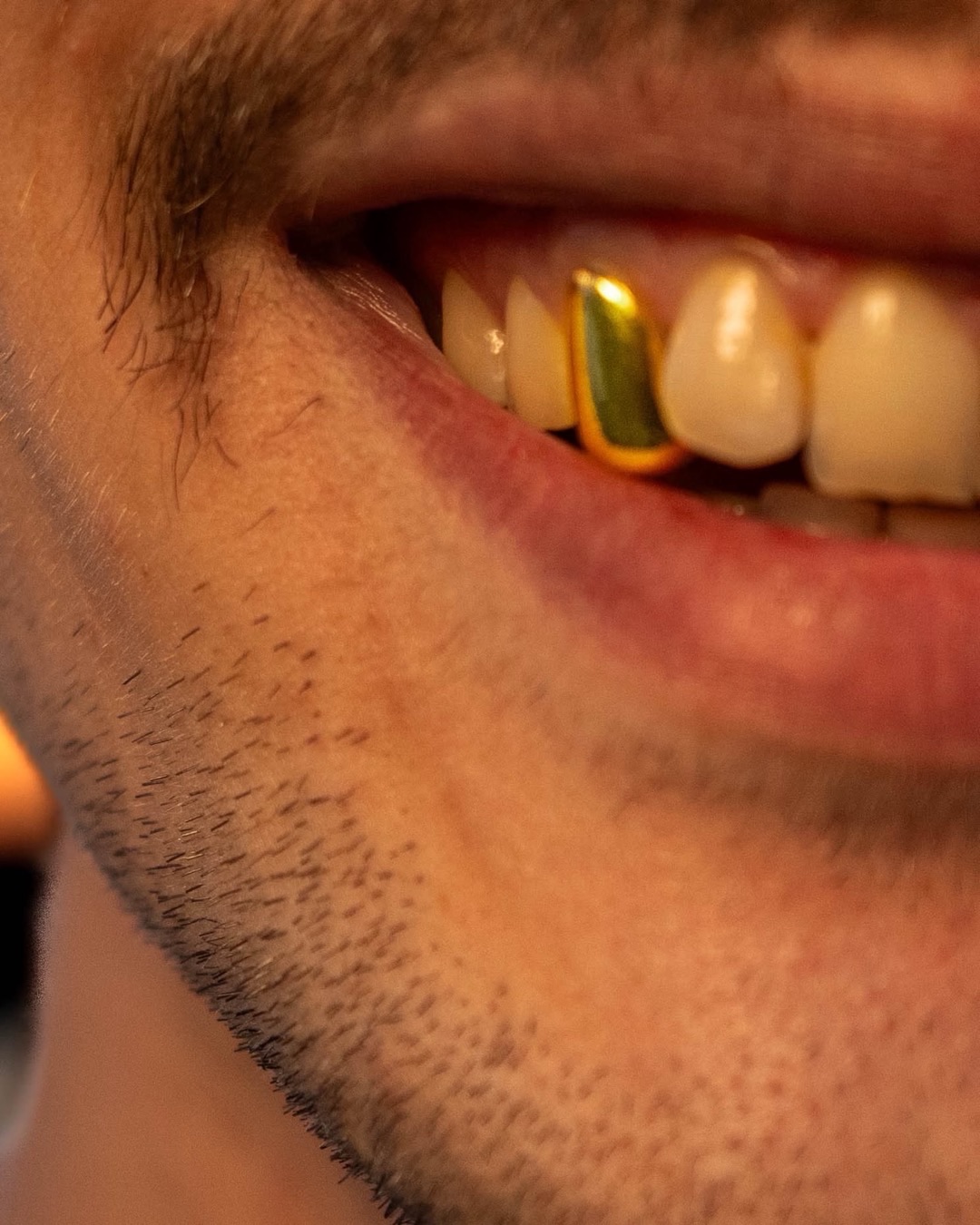 Grillz en or porté, sourire au coucher du soleil
