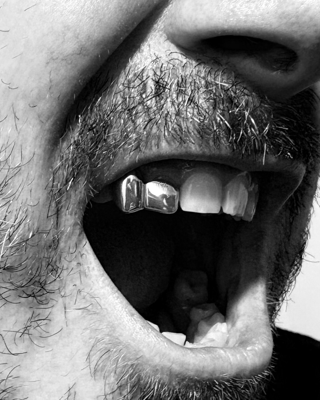 Grillz en argent sur deux dents